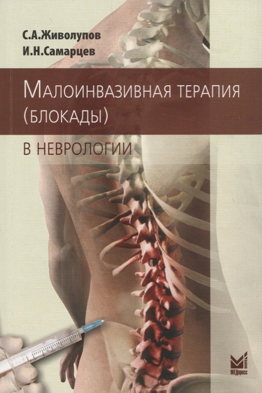 Малоинвазивная терапия (блокады) в неврологии