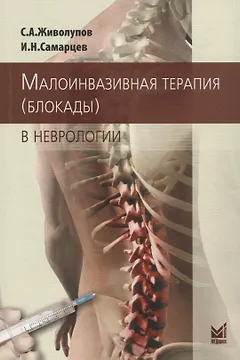 Малоинвазивная терапия (блокады) в неврологии