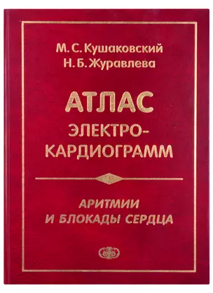 Атлас электрокардиограмм. Аритмии и блокады сердца. Изд.четвертое перераб. и дополн. — 2647731 — 1