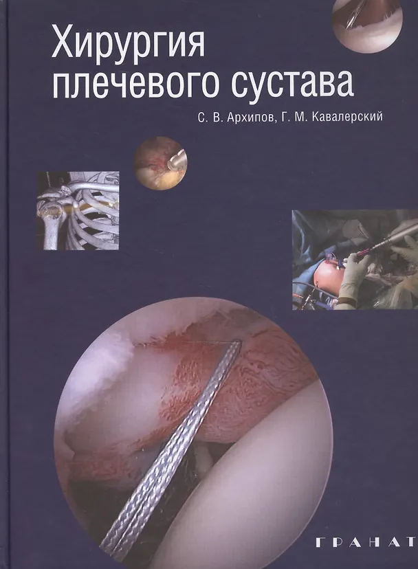 Книга Хирургия плечевого сустава (Сергей Архипов) — 1