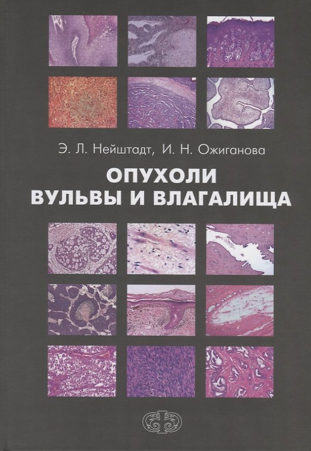 Книга Опухоли вульвы и влагалища () — 1