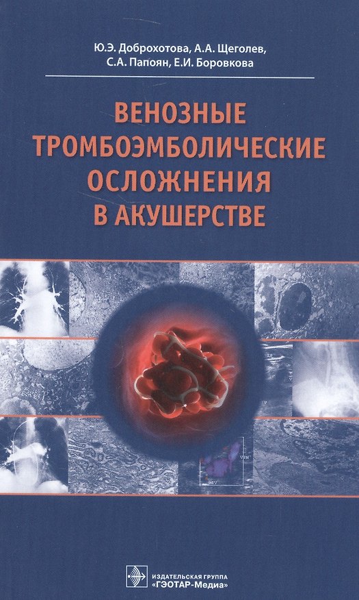 Книга Венозные тромбоэмболические осложнения в акушерстве () — 1