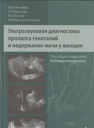 Книга Ультразвуковая диагностика пролапса гениталий и недержания мочи у женщин (Марина Чечнева)