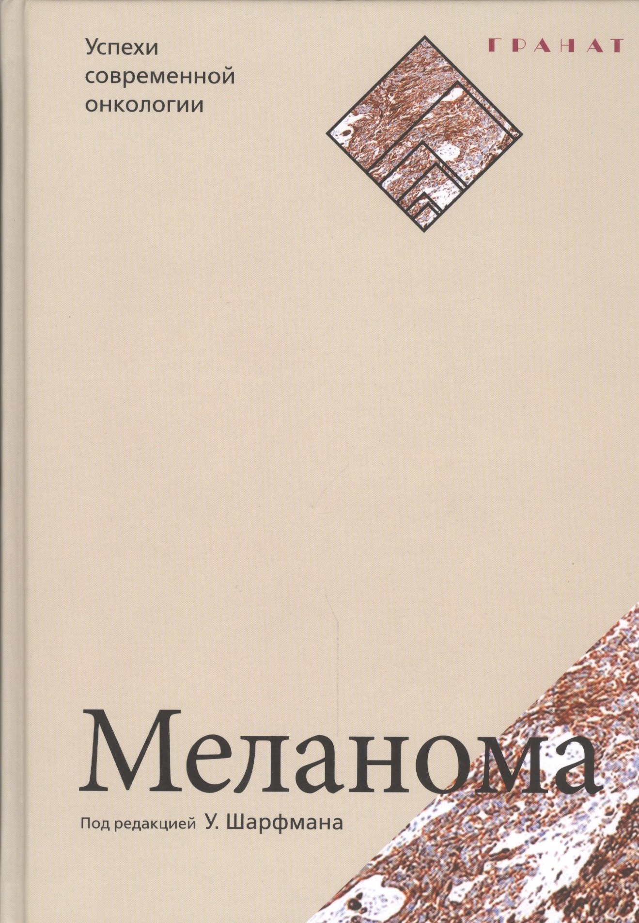 

Меланома. Серия «Успехи современной онкологии» № 1.