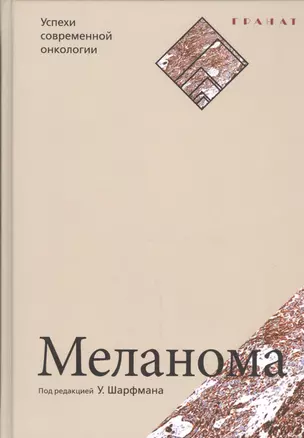 Меланома. Серия «Успехи современной онкологии» № 1. — 2449820 — 1