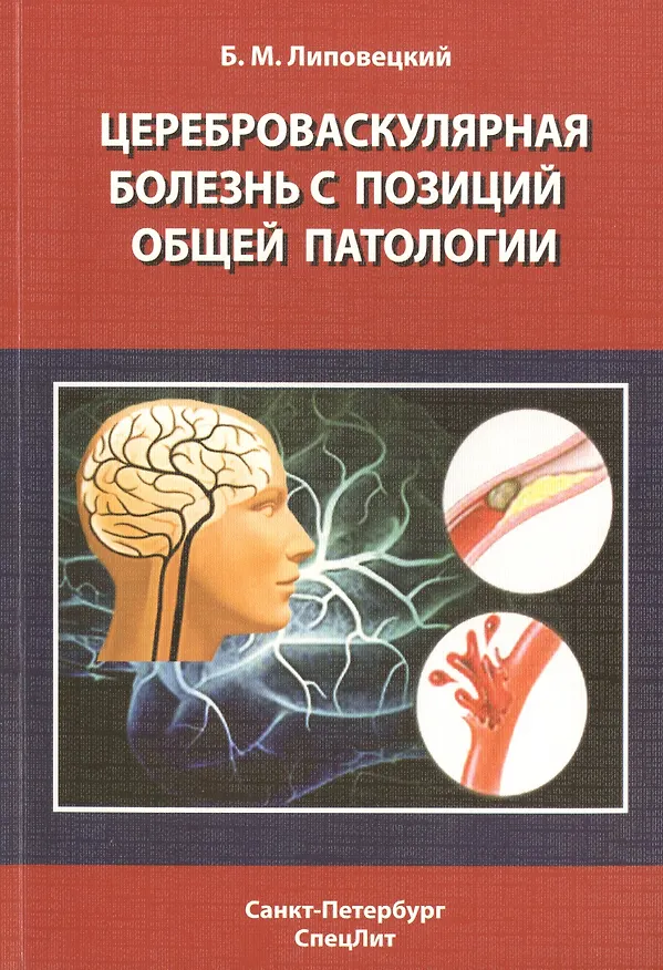 Книга Цереброваскулярная болезнь с позиций общей патологии (Борис Липовецкий) — 1
