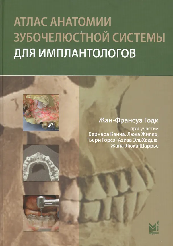 Книга Атлас анатомии зубочелюстной системы для имплантологов (Жан Годи) — 1