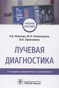 Лучевая диагностика