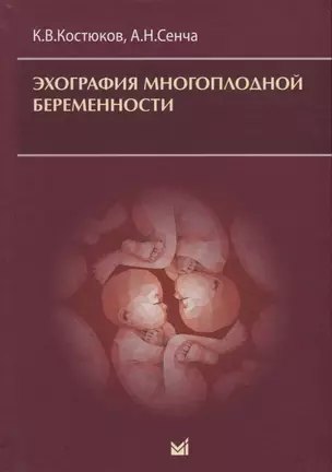 Эхография многоплодной беременности — 2742005 — 1