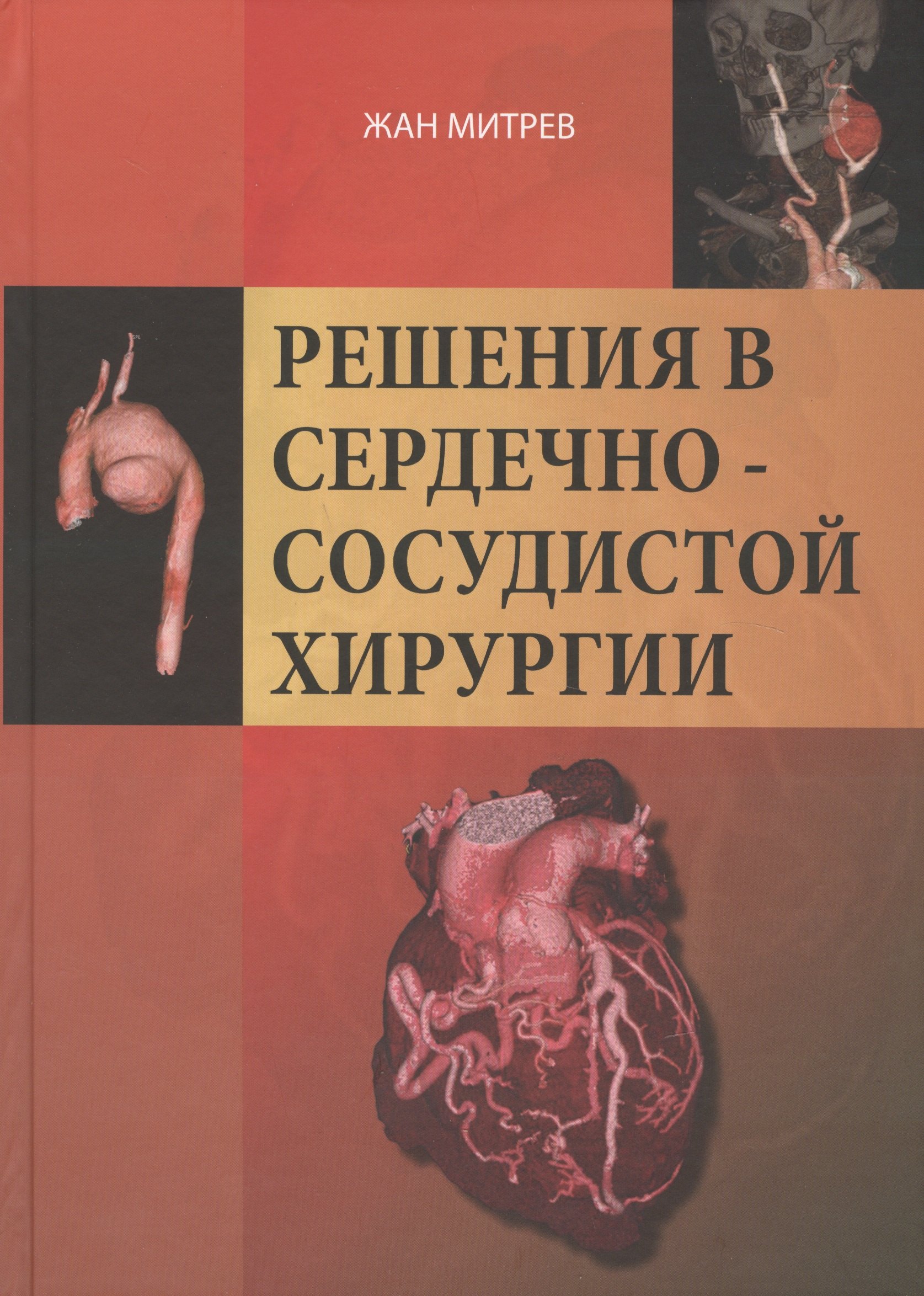 

Решение сердечно-сосудистой хирургии