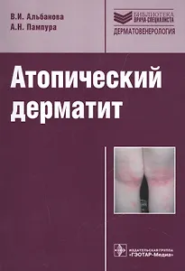 Атопический дерматит