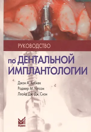 Книга Руководство по дентальной имплантологии / 2-е изд. (Джон Хобкек)