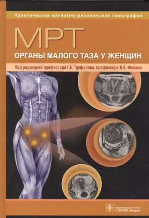 МРТ. Органы малого таза у женщин: руководство для врачей — 2851927 — 1