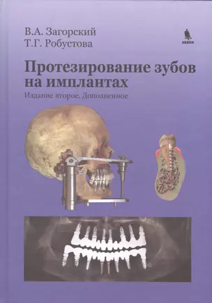 Протезирование зубов на имплантатах. Изд. 2-е, дополненное — 2531294 — 1