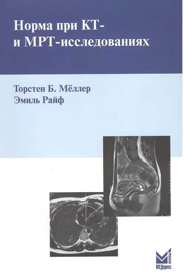 Книга Норма при КТ - и МРТ - исследованиях (Торстен Б. Меллер) — 1