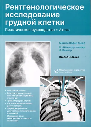 Книга Рентгенологическое исследование грудной клетки. Практическое руководство. Атлас (Матиас Хофер)
