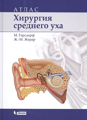 Книга Хирургия среднего уха: атлас (М. Герсдорф)