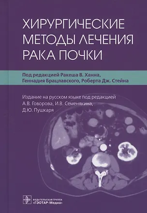 Книга Хирургические методы лечения рака почки ()