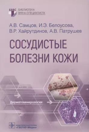 Сосудистые болезни кожи — 2934629 — 1