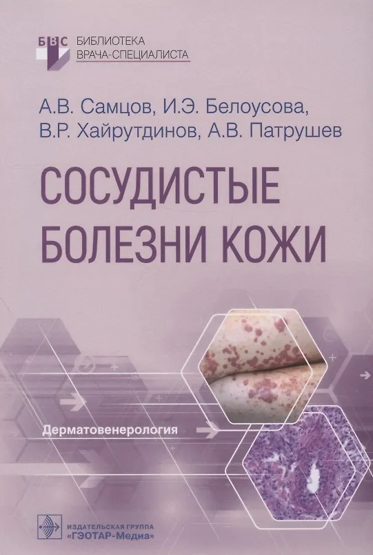 Книга Сосудистые болезни кожи (Ирена Белоусова, Владислав Хайрутдинов, Алексей Самцов) — 1