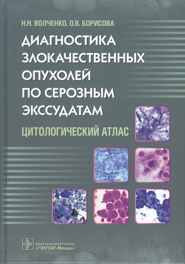 Книга Диагностика злокачественных опухолей по серозным экссудатам. (Надежда Волченко) — 1