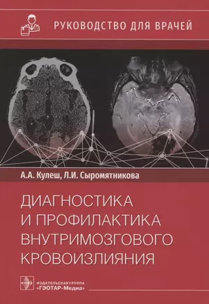 Диагностика и профилактика внутримозгового кровоизлияния. Руководство для врачей — 2859980 — 1