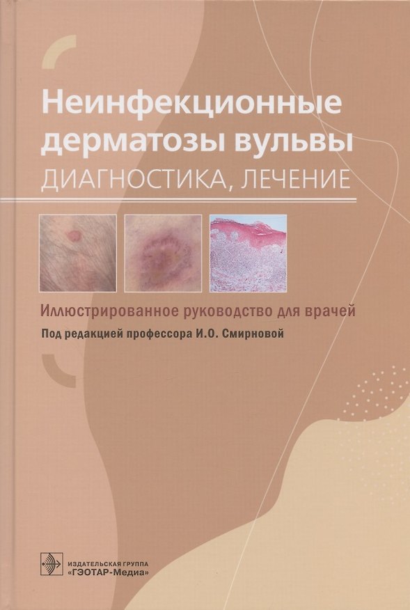 Книга Неинфекционные дерматозы вульвы: диагностика, лечение. Иллюстрированное руководство для врачей () — 1