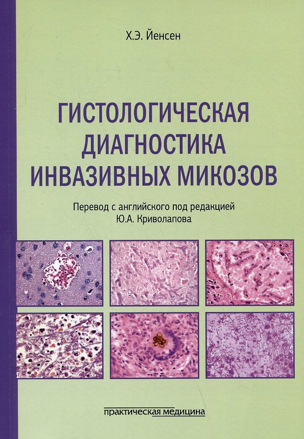 Книга Гистологическая диагностика инвазивных микозов (Хенрик Йенсен) — 1