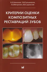 Критерии оценки композитных реставраций зубов