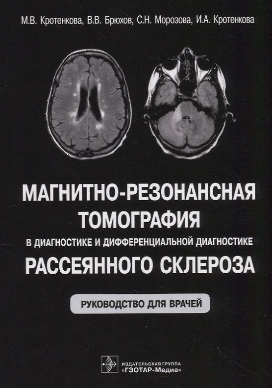 Книга Магнитно-резонансная томография в диагностике и дифференциальной диагностике рассеянного склероза. Руководство для врачей () — 1