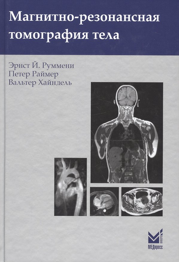 Книга Магнитно-резонансная томография тела () — 1