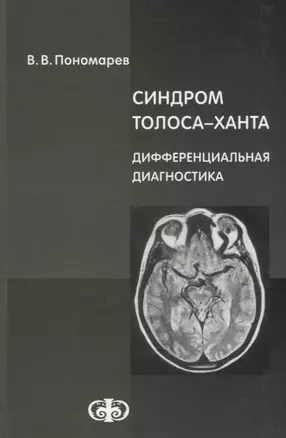 Синдром Толоса-Ханта. Дифференциальная диагностика — 2659990 — 1