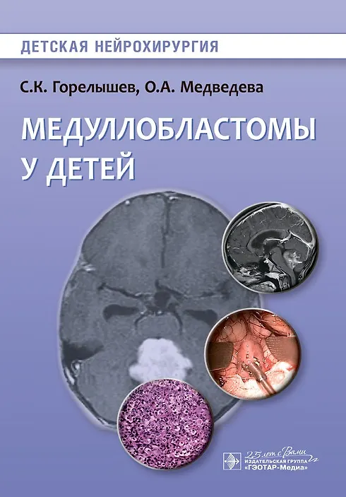 Книга Медуллобластомы у детей (Сергей Горелышев) — 1