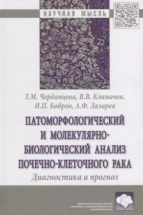 Патоморфологический и молекулярно-биологический анализ почечно-клеточного рака. Диагностика и прогноз. Монография — 2796815 — 1