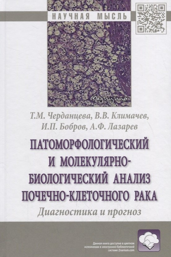 Книга Патоморфологический и молекулярно-биологический анализ почечно-клеточного рака. Диагностика и прогноз. Монография () — 1