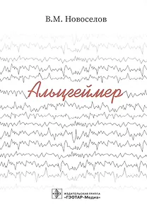 Альцгеймер