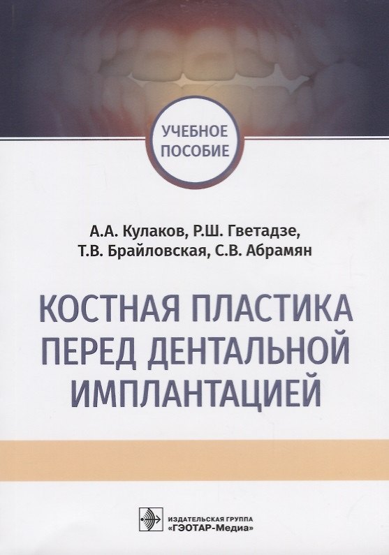 Книга Костная пластика перед дентальной имплантацией Учебное пособие () — 1