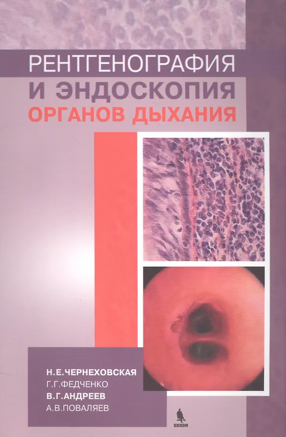 Книга Рентгенография и эндоскопия органов дыхания (Наталья Чернеховская) — 1