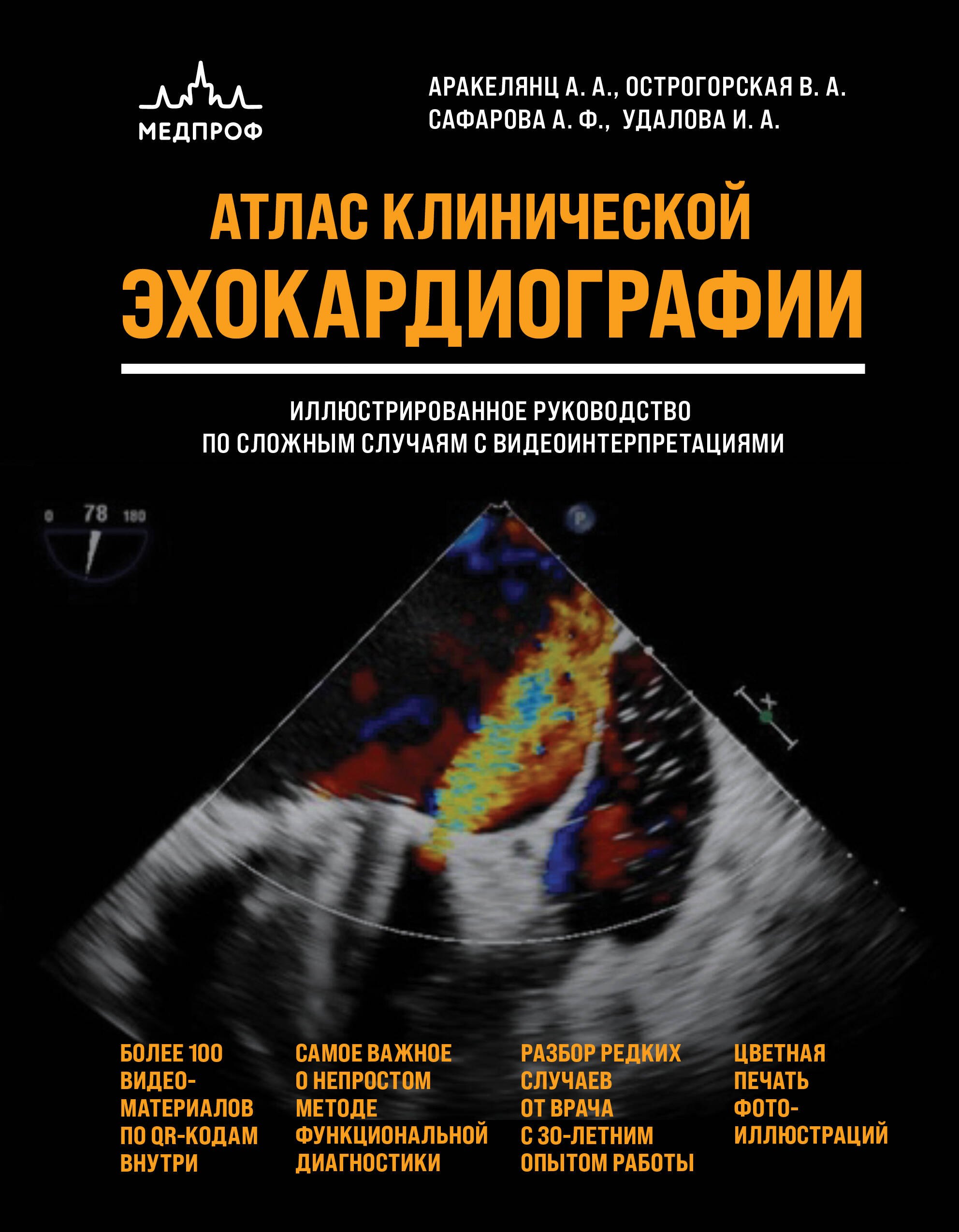 Аракелянц Амалия Ашотовна, Острогорская Вера Анатольевна, Сафарова Айтен Фуад кызы, Удалова Ирина Аркадьевна Атлас ЭхоКГ. Иллюстрированное руководство по сложным случаям с видеоинтерпретациями