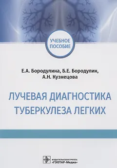 Лучевая диагностика туберкулеза легких. Учебное пособие