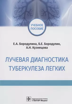 Лучевая диагностика туберкулеза легких. Учебное пособие — 2825170 — 1