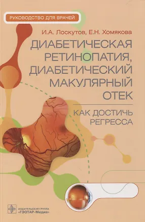 Книга Диабетическая ретинопатия, диабетический макулярный отек — как достичь регресса : руководство для врачей (Игорь Лоскутов, Елена Хомякова)