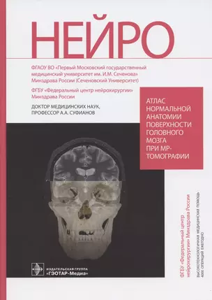 Атлас нормальной анатомии поверхности головного мозга при МР-томографии — 2844260 — 1