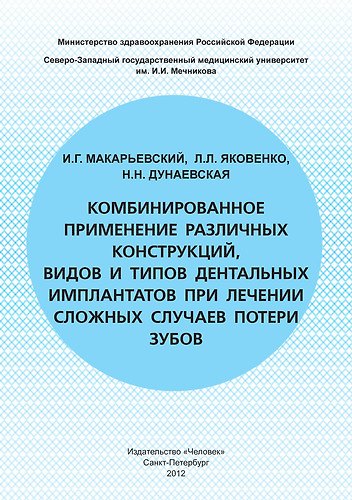 Комбинированное применение различных конструкций видов и типов дентальных имплантатов при лечении сложных случаев потери зубов 309561 — 1
