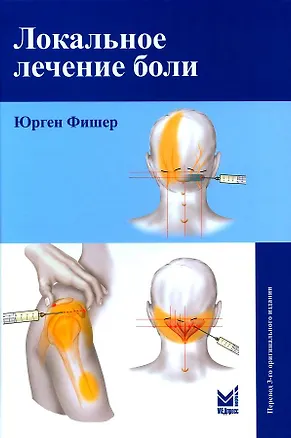 Книга Локальное лечение боли (Юрген Фишер)
