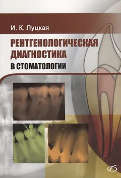 Рентгенологическая диагностика в стоматологии
