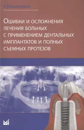 Ошибки и осложнения лечения больных с применением дентальных — 2576173 — 1