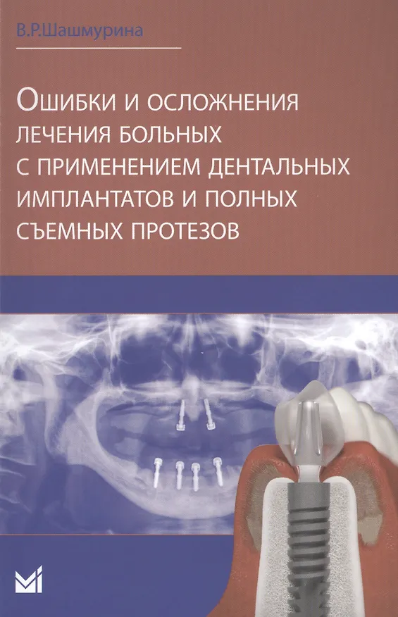 Книга Ошибки и осложнения лечения больных с применением дентальных () — 1