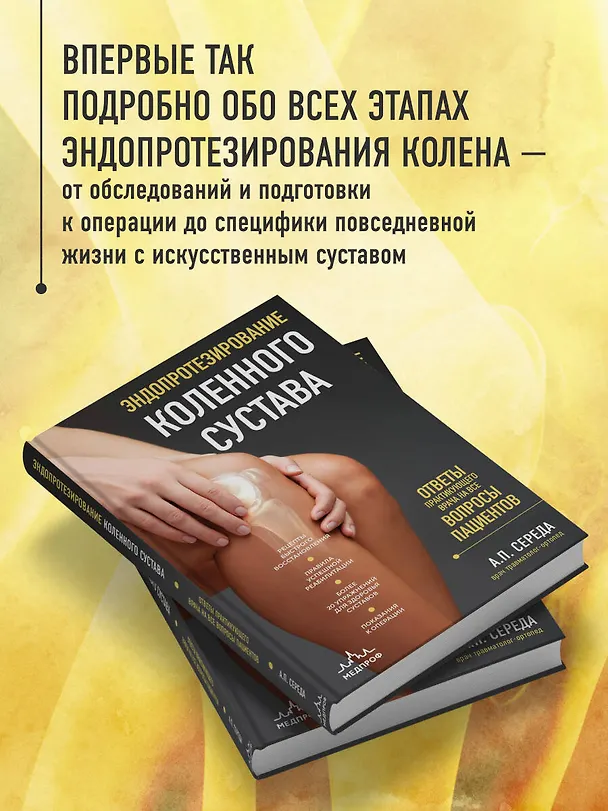 Книга Эндопротезирование коленного сустава: ответы практикующего врача на все вопросы пациентов (Андрей Середа) — 6