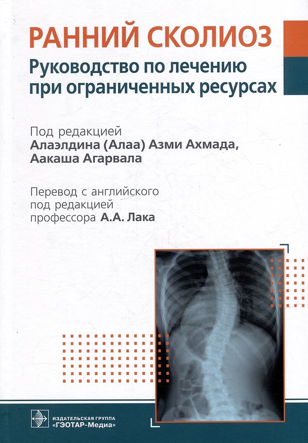 Книга Ранний сколиоз. Руководство по лечению при ограниченных ресурсах () — 1